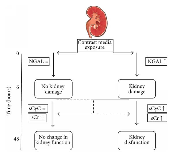 胱抑素C（CysC）與NGAL、肌酐的關(guān)系